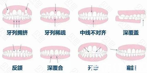 2023青岛牙错位矫正医院排行五强重磅来袭！（天一牙博士口碑评价极高）(图1)
