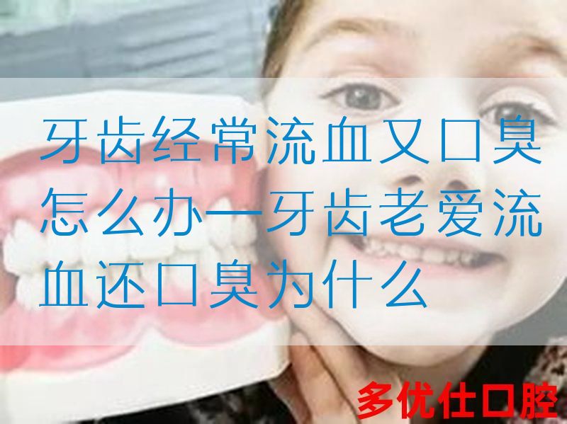 牙齿*常流血又口臭怎么办—牙齿老爱流血还口臭为什么
