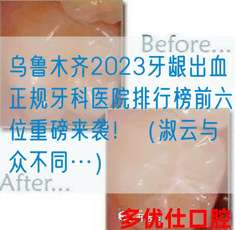 *2023牙龈出血正规牙科医院排行榜前六位重磅来袭！（淑云与众不同…）