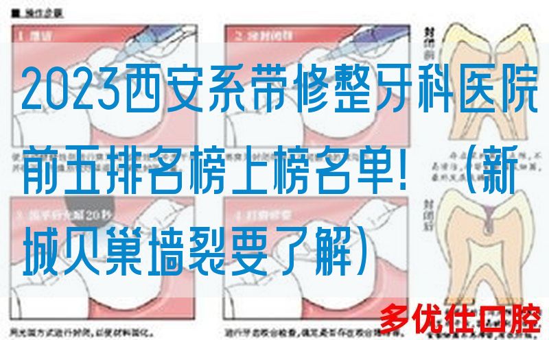 2023西安系带修整牙科医院前五排名榜上榜名单！（新城贝巢墙裂要了解）