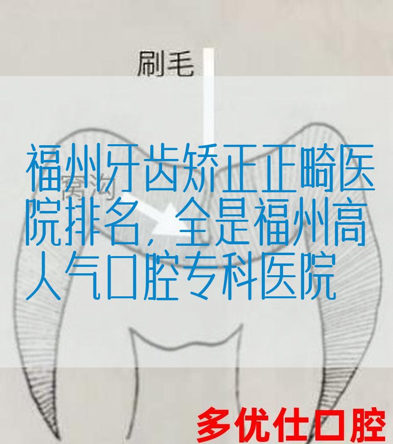 福州牙齿矫正正畸医院排名，全是福州高人气口腔专科医院