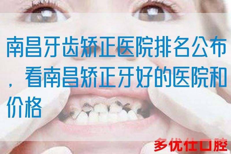 南昌牙齿矫正医院排名公布，看南昌矫正牙好的医院和价格