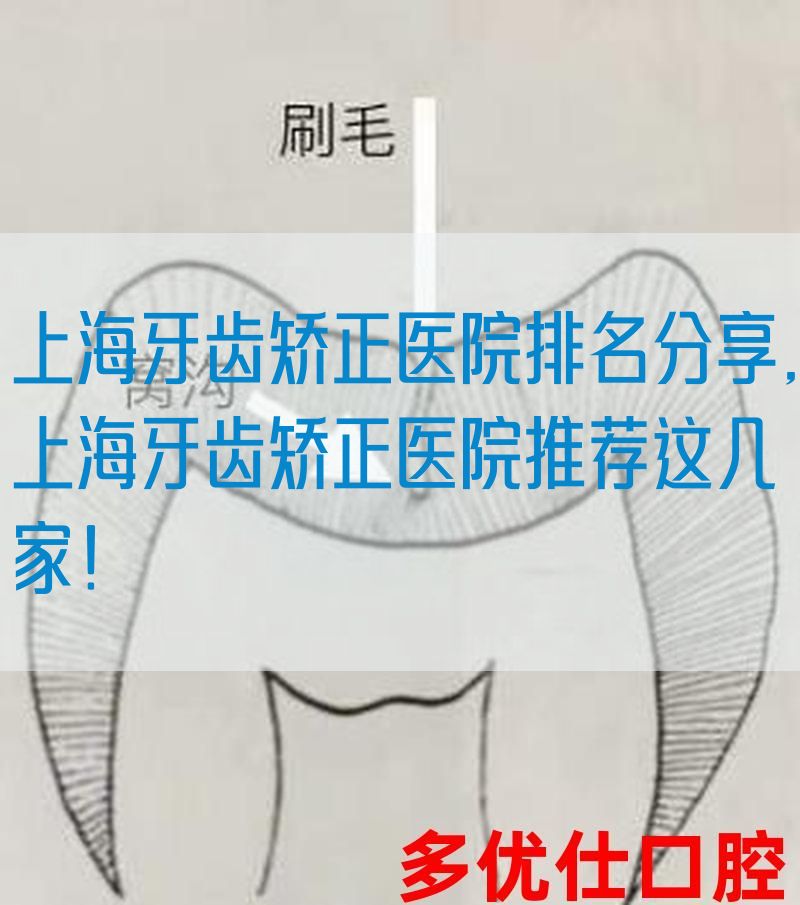上海牙齿矫正医院排名分享,上海牙齿矫正医院推荐这几家！