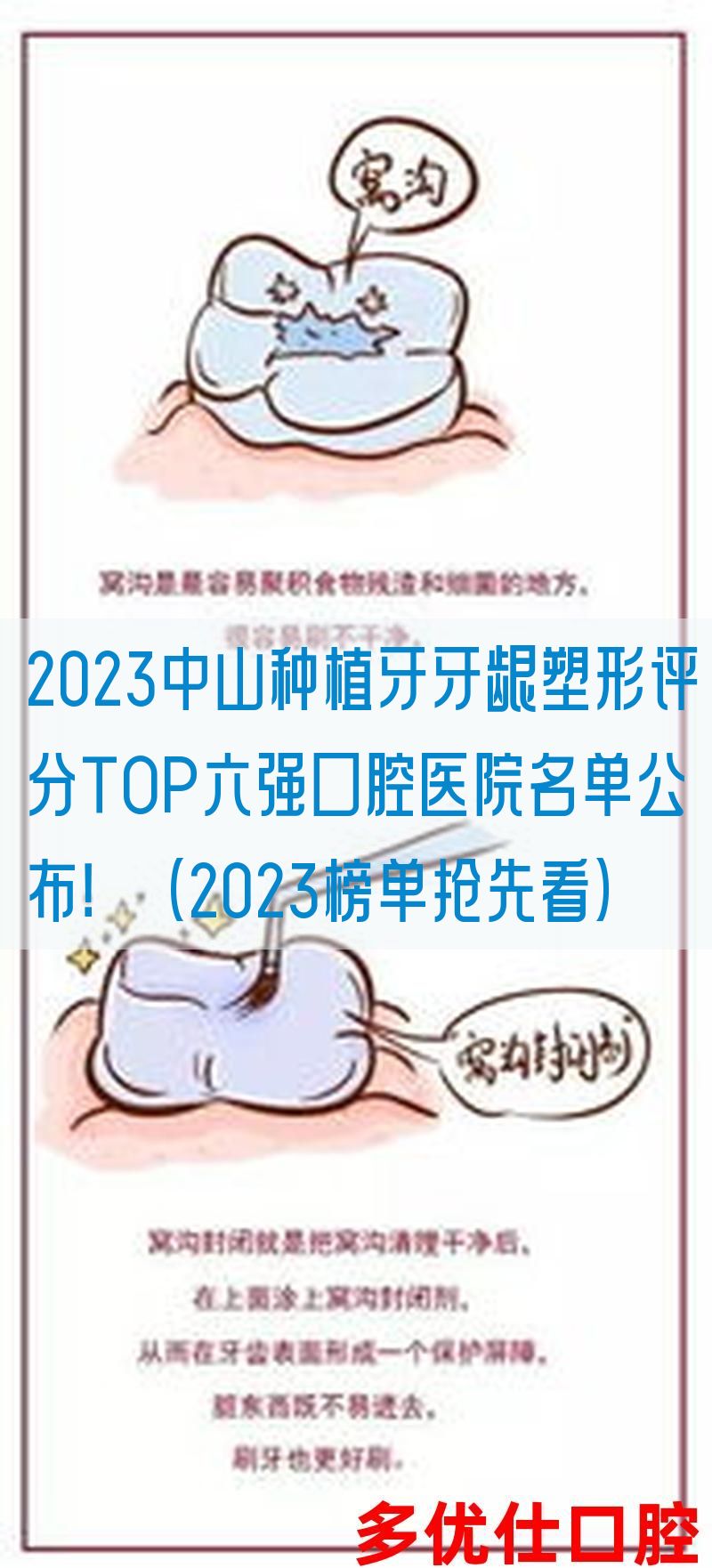 2023中山种植牙牙龈塑形评分TOP六强口腔医院名单公布！（2023榜单抢先看）