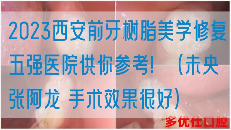 2023西安前牙树脂美学修复五强医院供你参考！（未央张阿龙 手术效果很好）