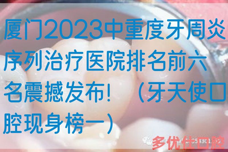 厦门2023中重度牙周炎序列治疗医院排名前六名震撼发布！（牙天使口腔现身榜一）