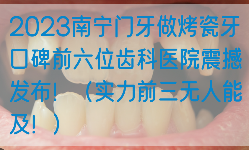 2023南宁门牙做烤瓷牙口碑前六位齿科医院震撼发布！（实力前三无人能及！）
