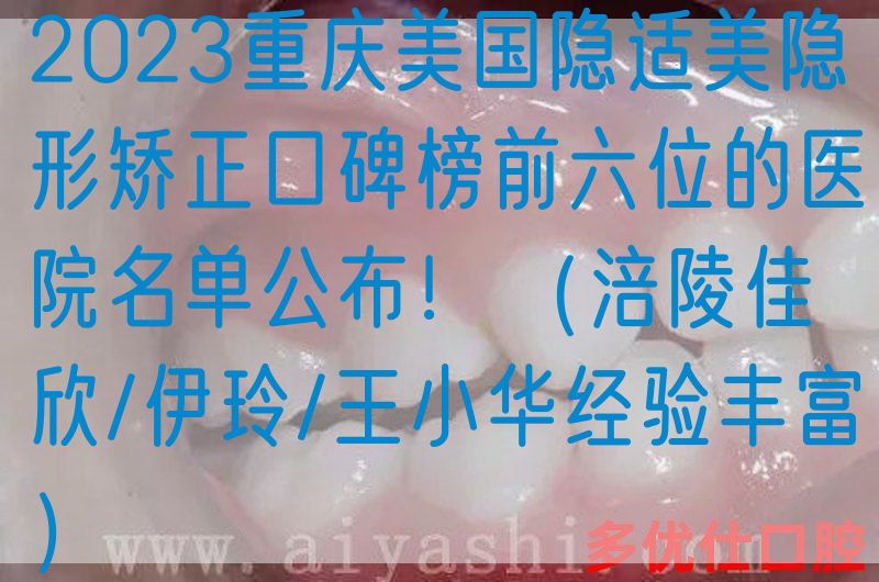 2023重庆美国隐适美隐形矫正口碑榜前六位的医院名单公布！（涪陵佳欣/伊玲/王小华*验丰富）