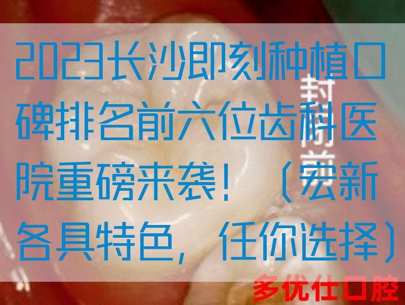 2023长沙即刻种植口碑排名前六位齿科医院重磅来袭！（宏新各具特色，任你选择）