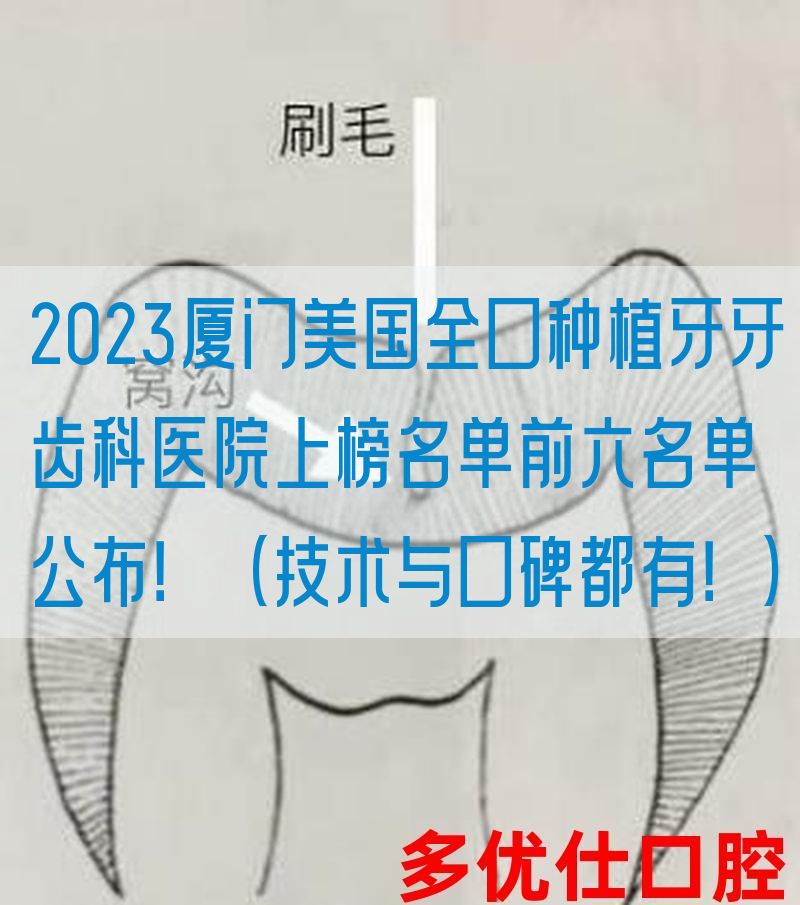 2023厦门美国全口种植牙牙齿科医院上榜名单前六名单公布！（技术与口碑都有！）
