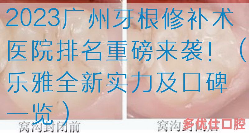 2023广州牙根修补术医院排名重磅来袭！（乐雅全新实力及口碑一览）