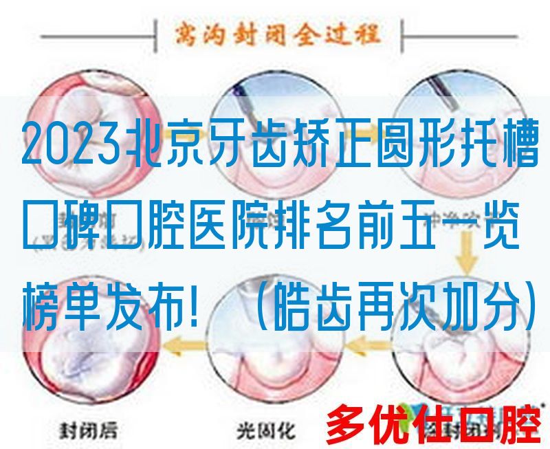 2023北京牙齿矫正圆形托槽口碑口腔医院排名前五一览榜单发布！（皓齿再次加分）