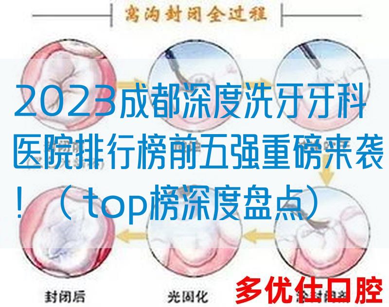 2023成都深度洗牙牙科医院排行榜前五强重磅来袭！（ top榜深度盘点）