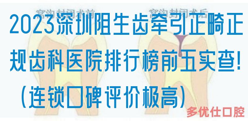 2023深圳阻生齿*正畸正规齿科医院排行榜前五实查！（连锁口碑评价极高）