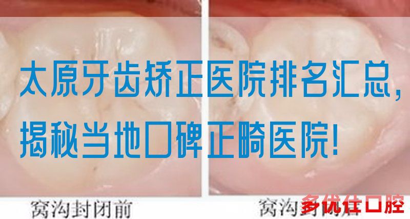 太原牙齿矫正医院排名汇总，揭秘当地口碑正畸医院！