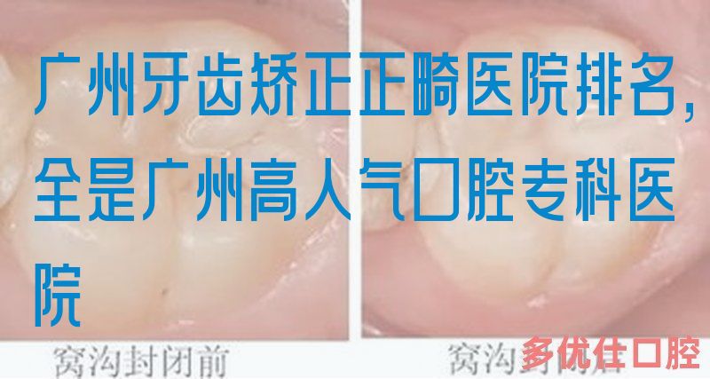 广州牙齿矫正正畸医院排名，全是广州高人气口腔专科医院