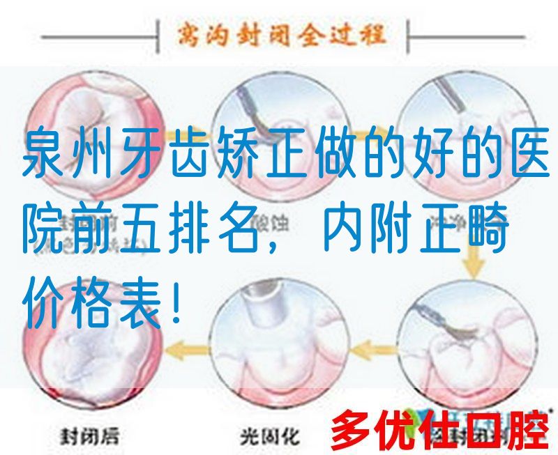泉州牙齿矫正做的好的医院前五排名，内附正畸价格表！