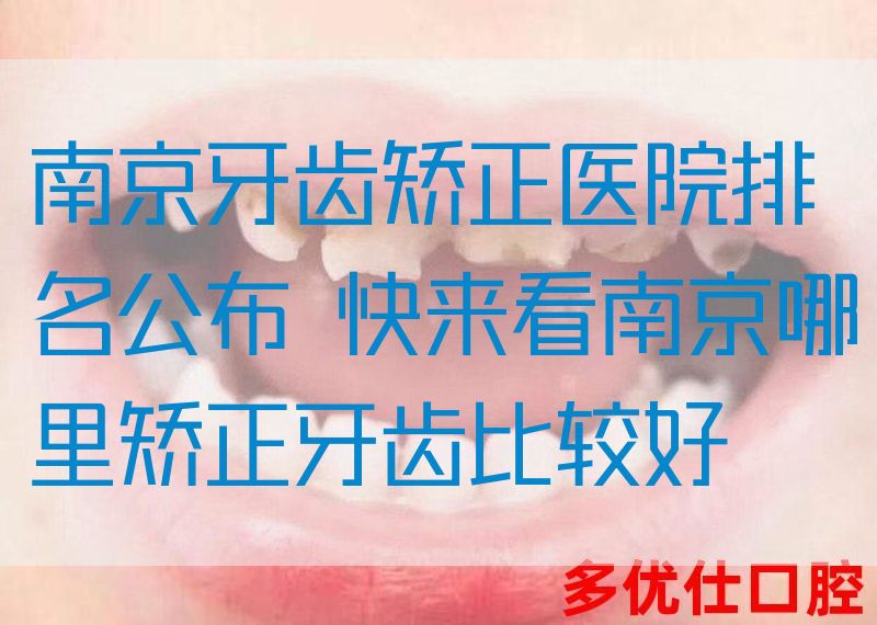 南京牙齿矫正医院排名公布 快来看南京哪里矫正牙齿比较好