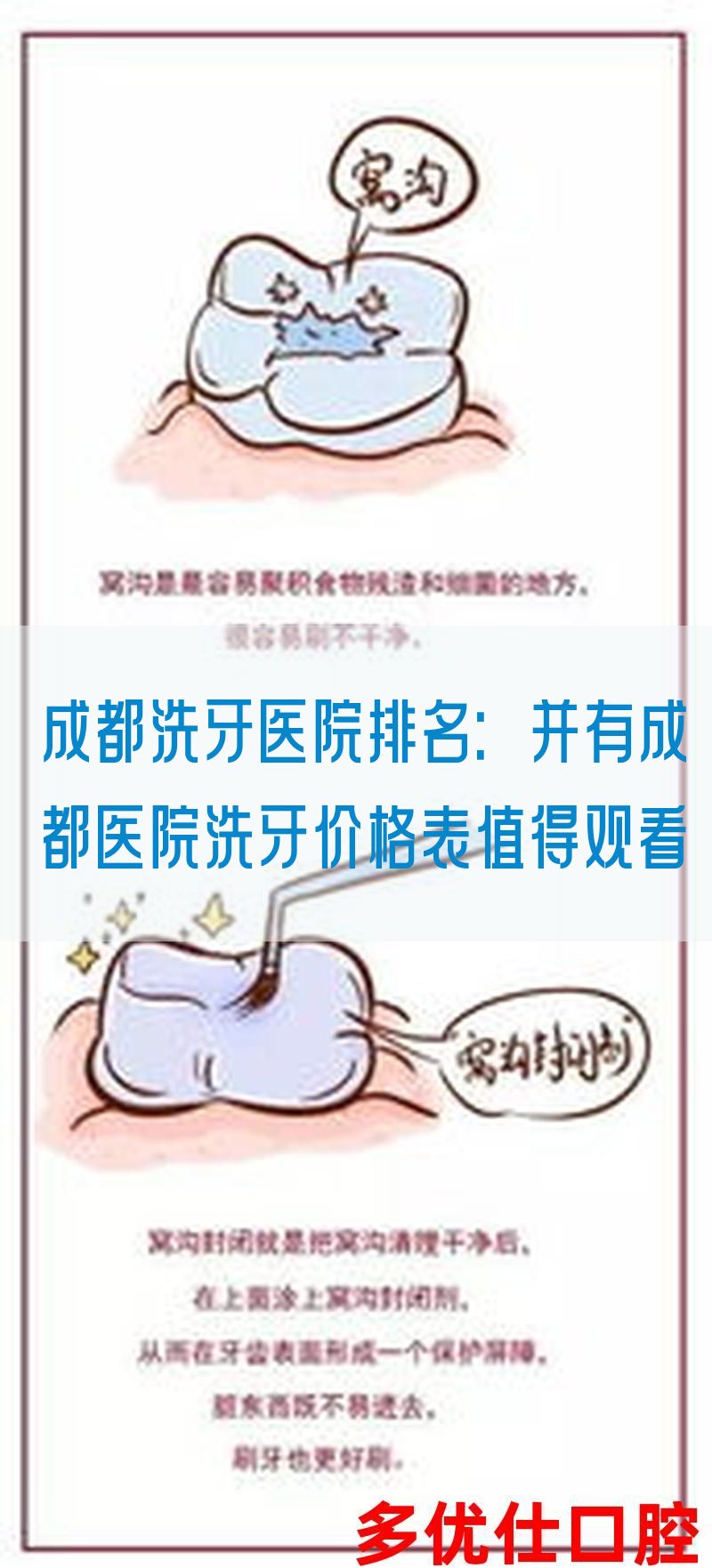 成都洗牙医院排名：并有成都医院洗牙价格表值得*