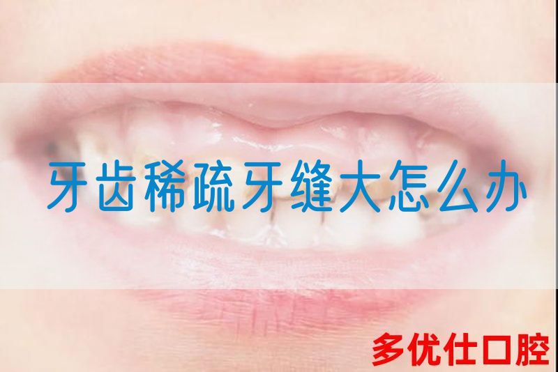 牙齿稀疏牙缝大怎么办(图1)