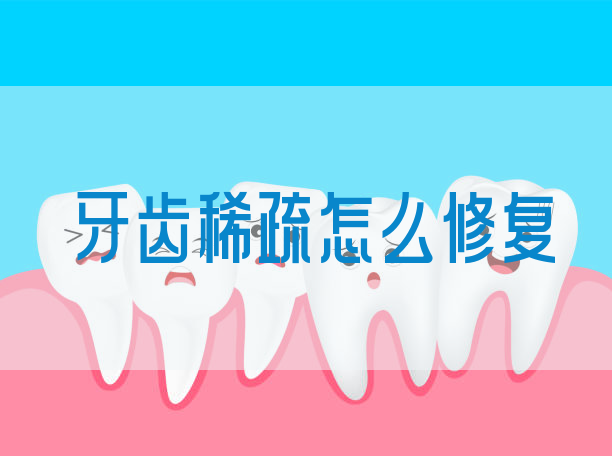 牙齿稀疏怎么修复(图1)
