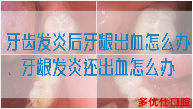 牙齿发炎后牙龈出血怎么办、牙龈发炎还出血怎么办