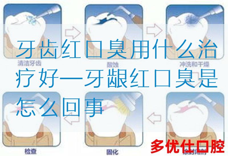 牙齿红口臭用什么治疗好—牙龈红口臭是怎么回事