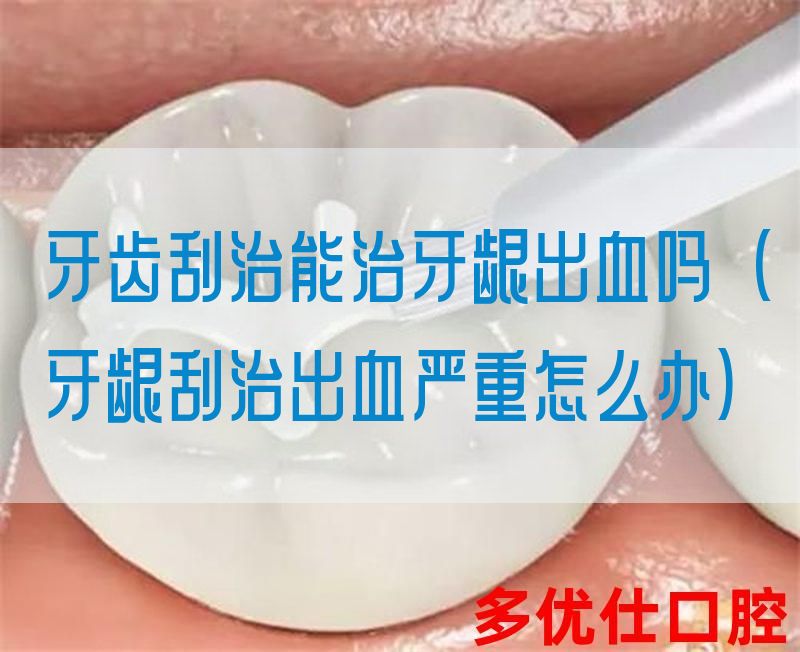 牙齿刮治能治牙龈出血吗(牙龈刮治出血严重怎么办)