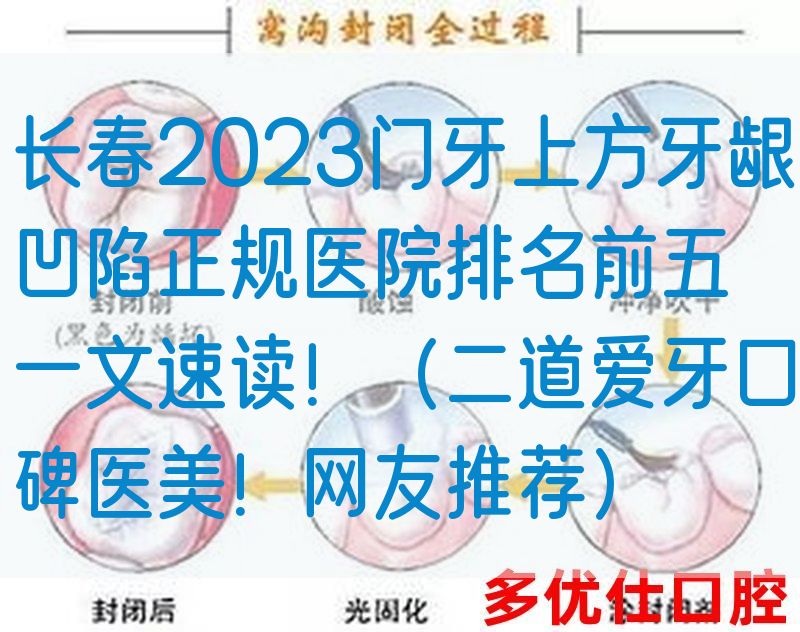 长春2023门牙上方牙龈凹陷正规医院排名前五一文速读！（二道爱牙口碑医美！网友推荐）