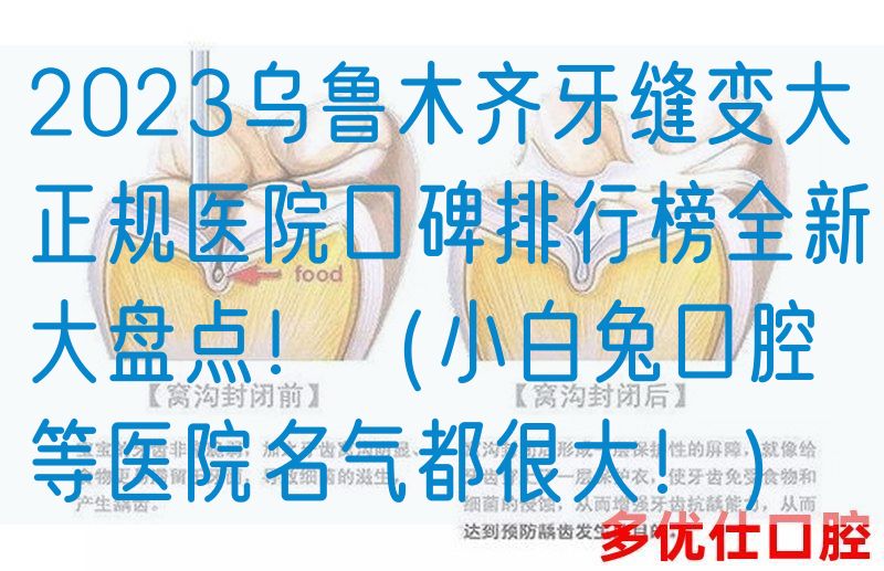 2023*牙缝变大正规医院口碑排行榜全新大盘点！（小白兔口腔等医院名气都很大！）