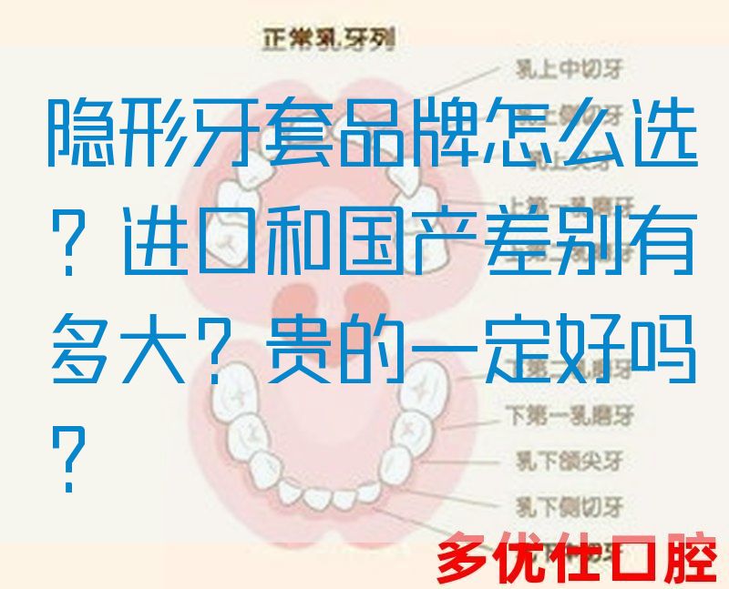 隐形牙套品牌怎么选？进口和国产差别有多大？贵的一定好吗？