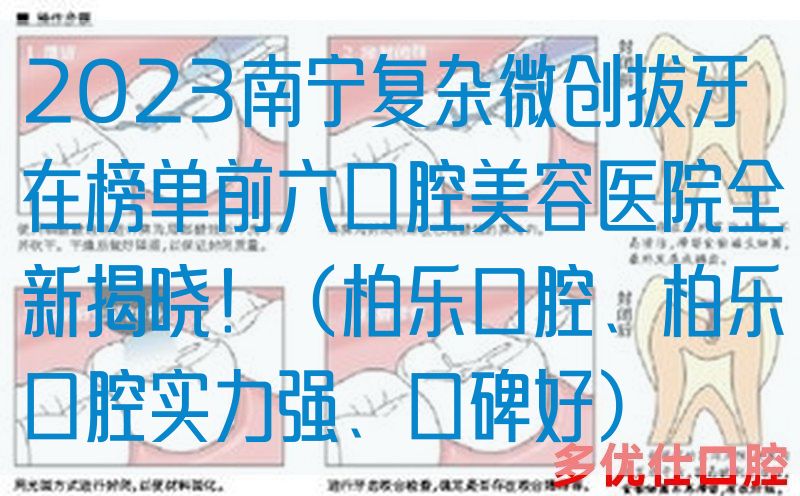 2023南宁复杂微创拔牙在榜单前六口腔美容医院全新揭晓！（柏乐口腔、柏乐口腔实力强、口碑好）