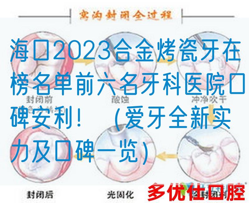 海口2023合金烤瓷牙在榜名单前六名牙科医院口碑安利！（爱牙全新实力及口碑一览）
