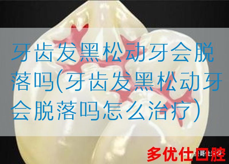 牙齿发黑松动牙会脱落吗(牙齿发黑松动牙会脱落吗怎么治疗)