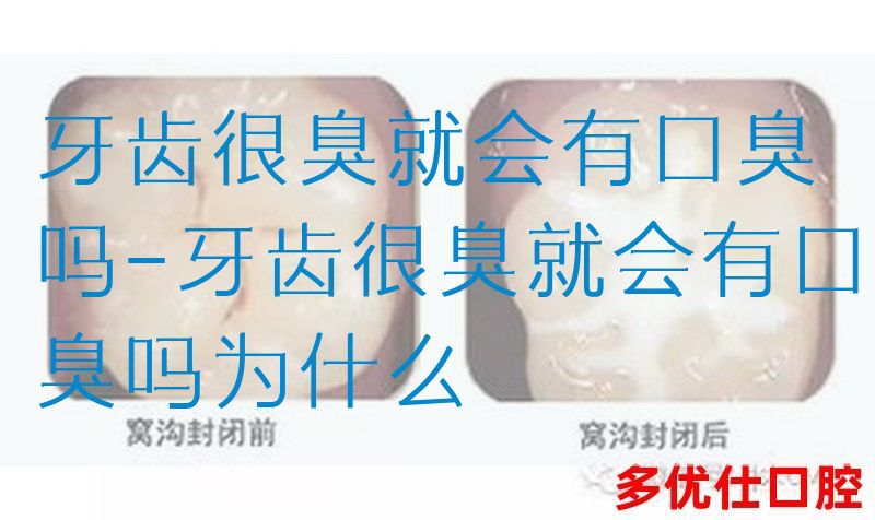 牙齿很臭就会有口臭吗-牙齿很臭就会有口臭吗为什么