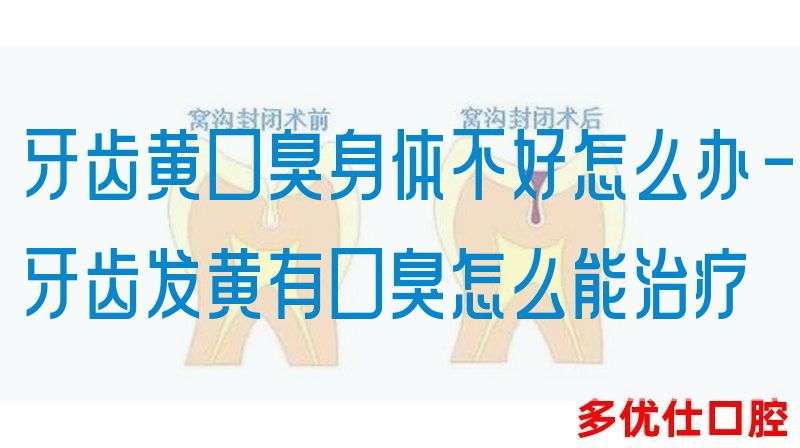 牙齿黄口臭身体不好怎么办-牙齿发黄有口臭怎么能治疗