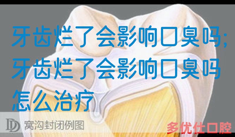 牙齿烂了会影响口臭吗;牙齿烂了会影响口臭吗怎么治疗