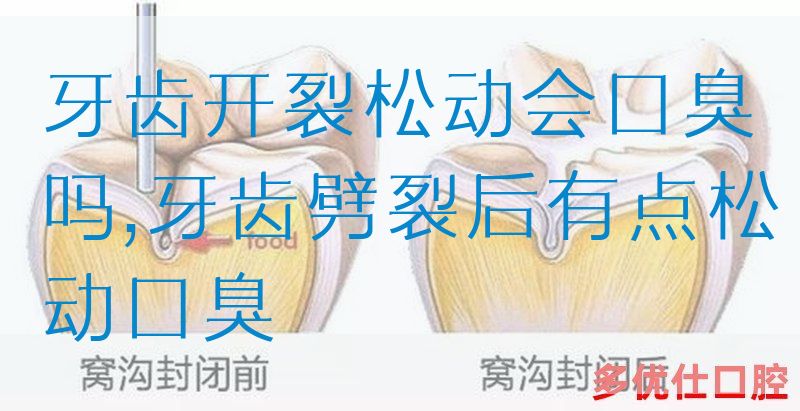 牙齿开裂松动会口臭吗,牙齿劈裂后有点松动口臭