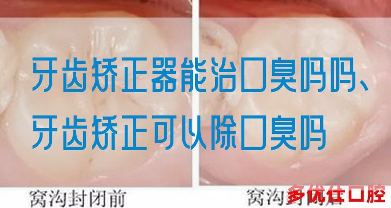 牙齿矫正器能治口臭吗吗、牙齿矫正可以除口臭吗