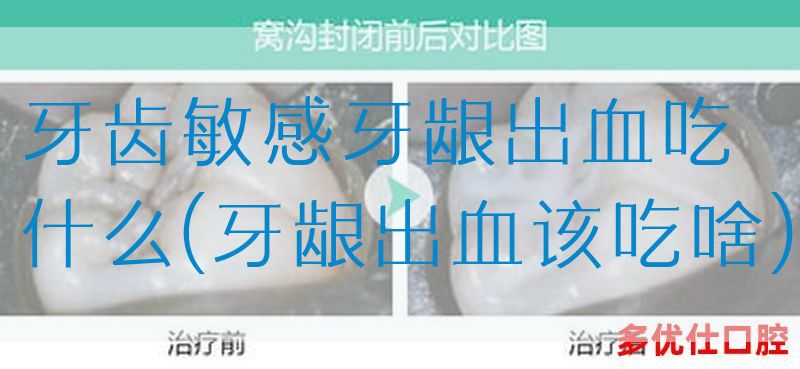 牙齿敏感牙龈出血吃什么(牙龈出血该吃啥)