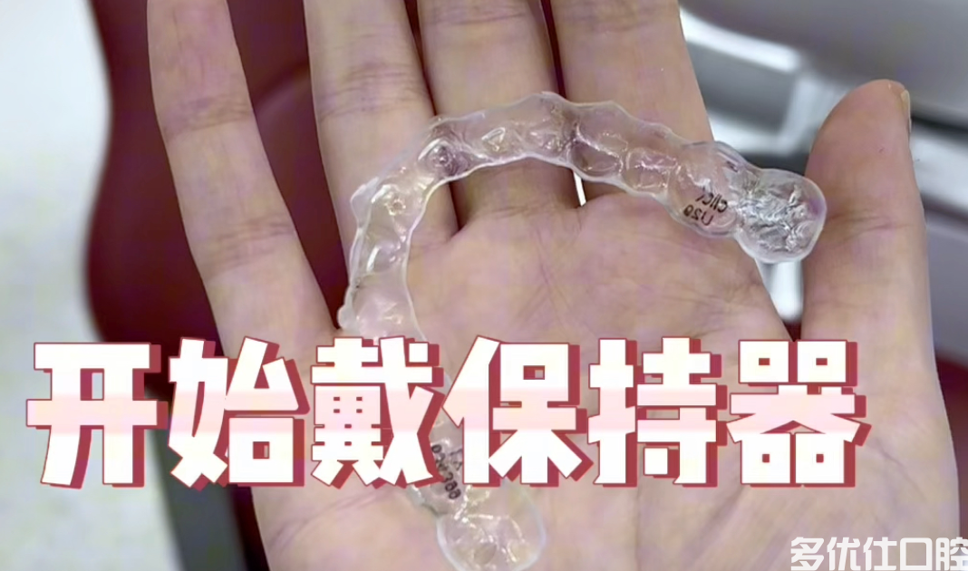 为什么钢丝保持器比透明保持器贵?区别居然是这个