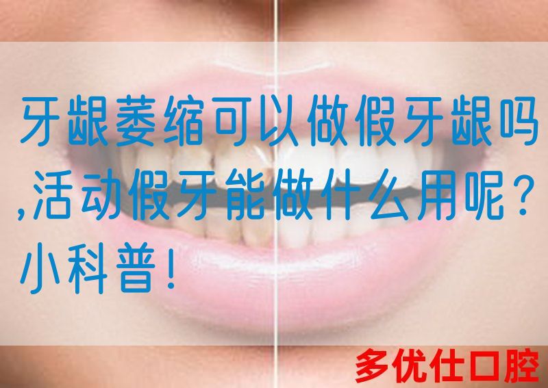 牙龈萎缩可以做假牙龈吗,活动假牙能做什么用呢？小科普！(图1)