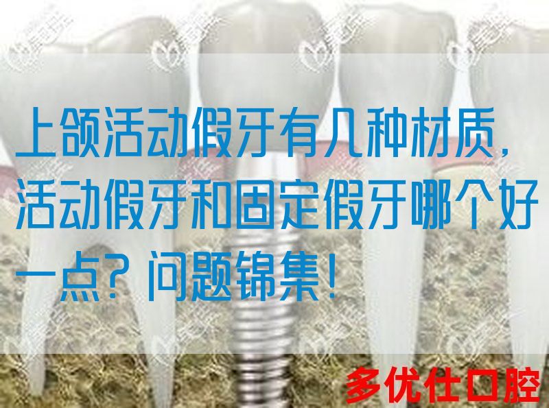 上颌活动假牙有几种材质,活动假牙和固定假牙哪个好一点？问题锦集！(图1)