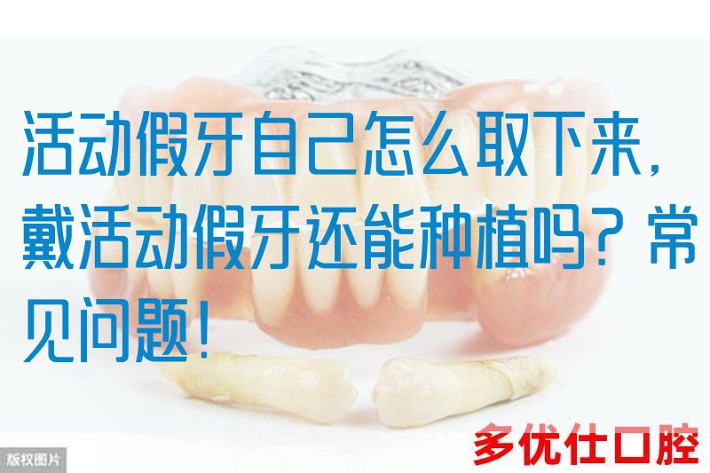 活动假牙自己怎么取下来,戴活动假牙还能种植吗？常见问题！(图1)