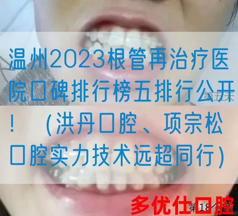 温州2023根管再治疗医院口碑排行榜五排行公开！（洪丹口腔、项宗松口腔实力技术远超同行）
