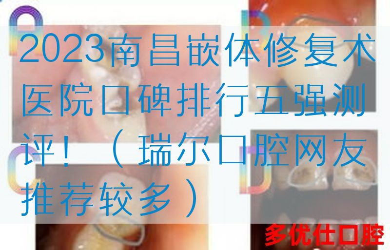 2023南昌嵌体修复术医院口碑排行五强测评！（瑞尔口腔网友推荐较多）