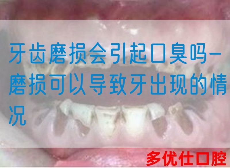 牙齿磨损会引起口臭吗-磨损可以导致牙出现的情况