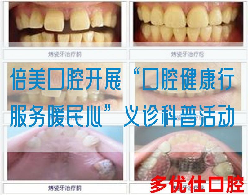 倍美口腔开展“口腔健康行 服务暖民心”义诊科普活动