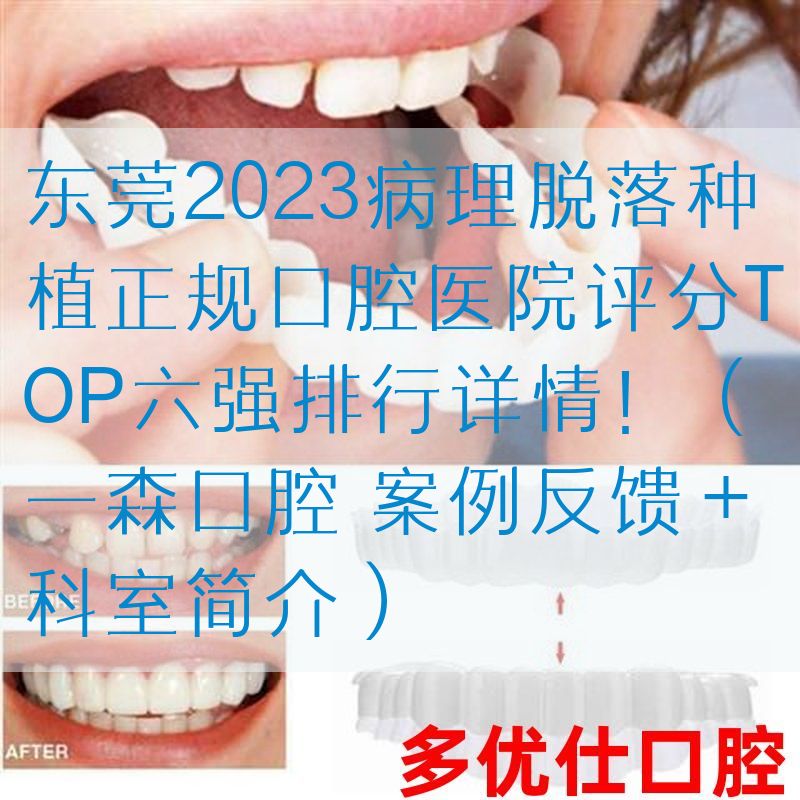 东莞2023病理脱落种植正规口腔医院评分TOP六强排行详情！（一森口腔 案例反馈＋科室简介）