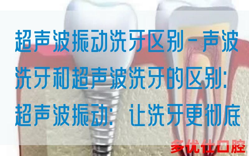 超声波振动洗牙区别-声波洗牙和超声波洗牙的区别：超声波振动：让洗牙更彻底